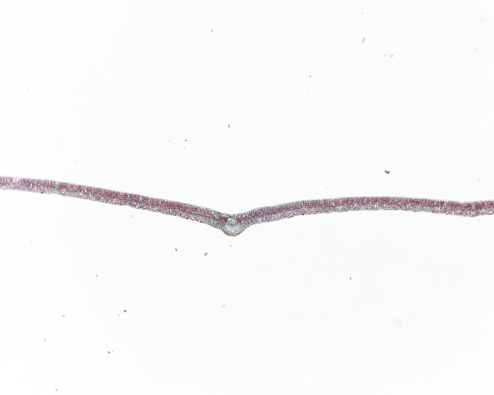 Syringa leaf cross section labeled