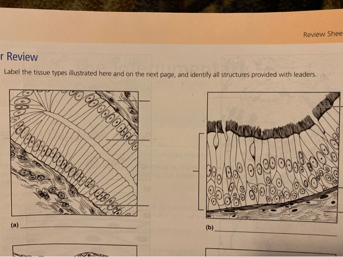 Label the tissue types illustrated here