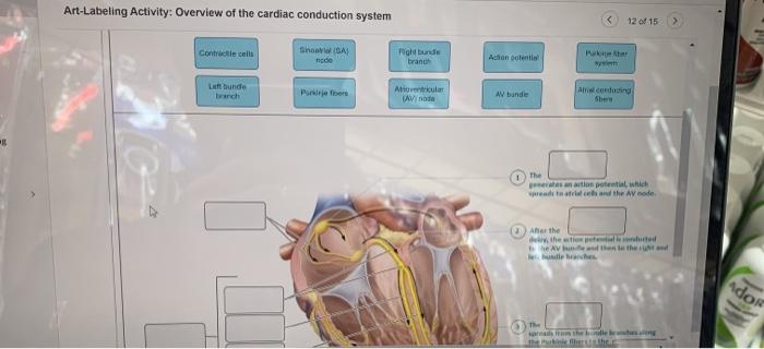 Art-labeling activity: overview of the cardiac conduction system