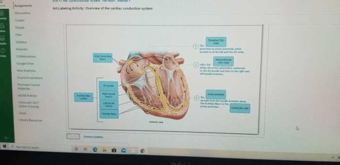 Art-labeling activity: overview of the cardiac conduction system